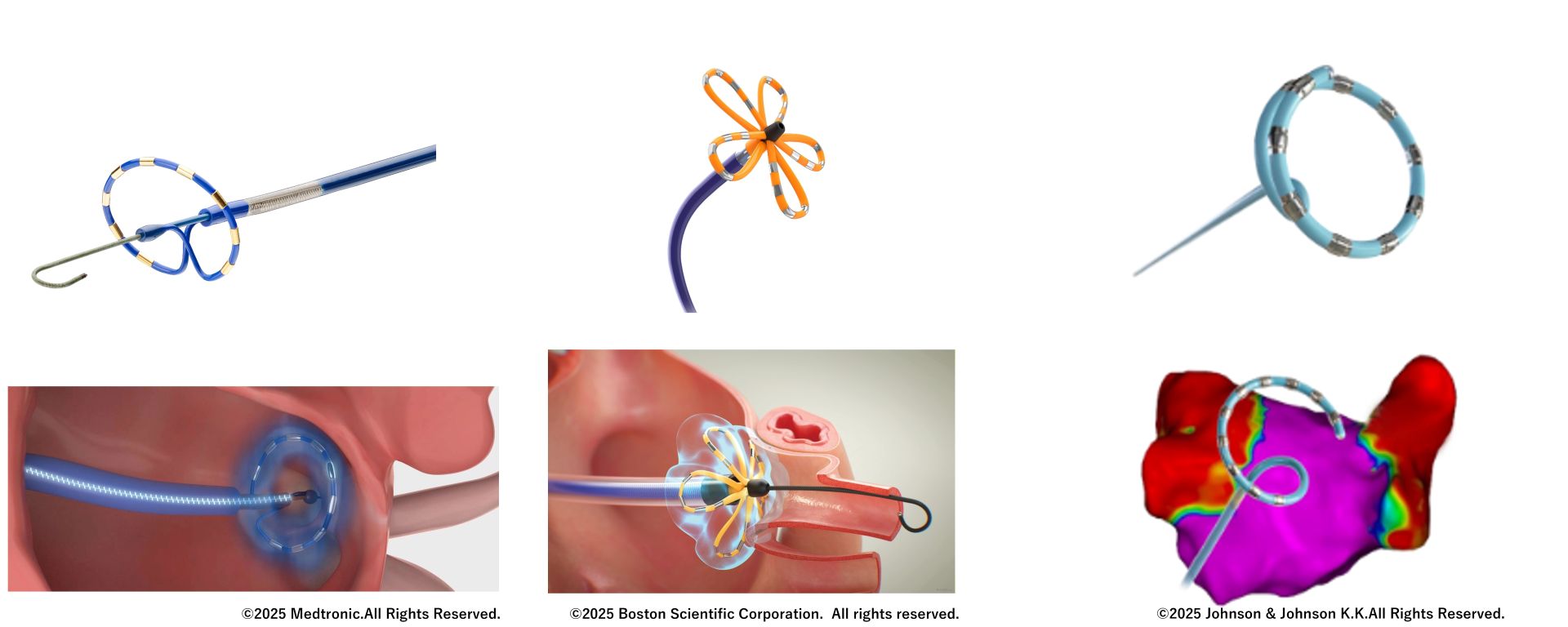 アブレーション治療器具イメージ